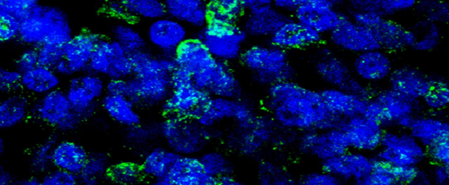 imagem de Estudo com minicérebros humanos revela efeitos de substância psicodélica