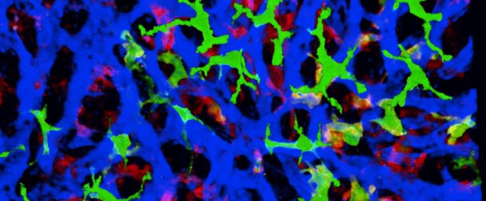 imagem de Órgão em transformação