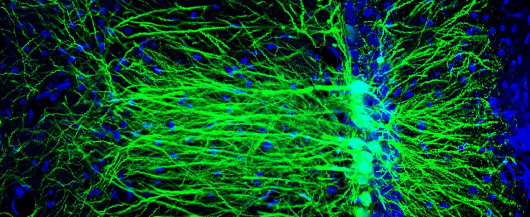 imagem de Neurobiologia do toque