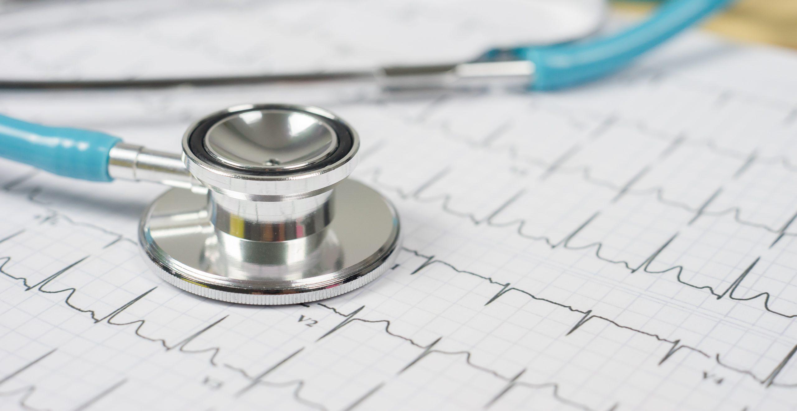 imagem de Arritmias cardíacas: perigo em crescimento