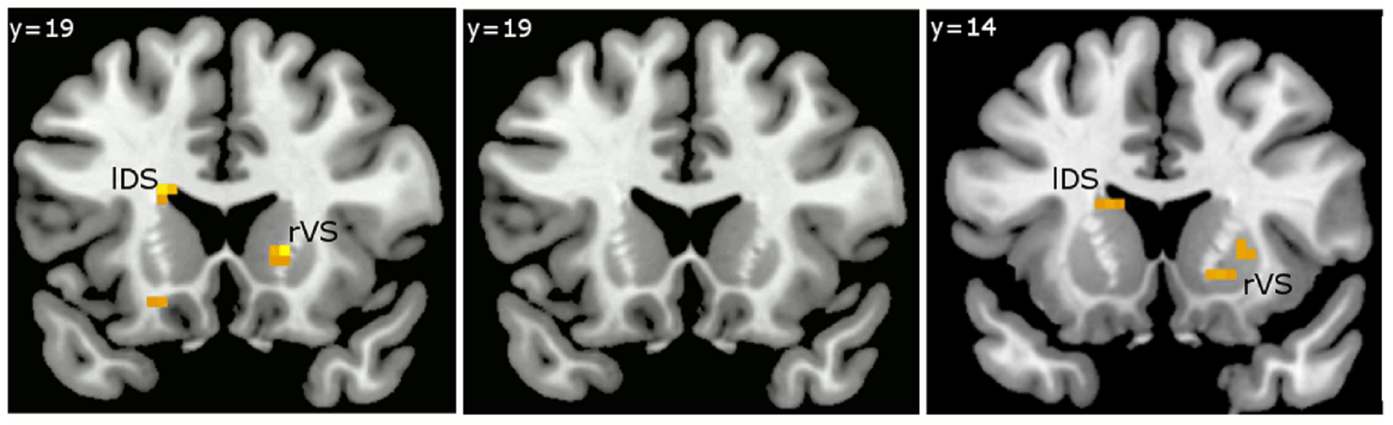 imagem de Apetite, impulsividade e recompensas