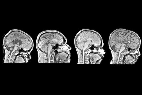 Adversidades geram transformações