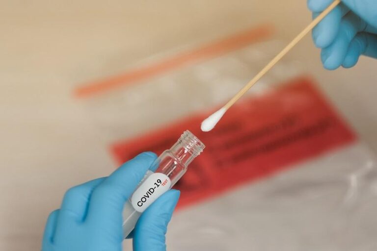 imagem de Testagem deve ser uma prioridade na luta contra a COVID-19
