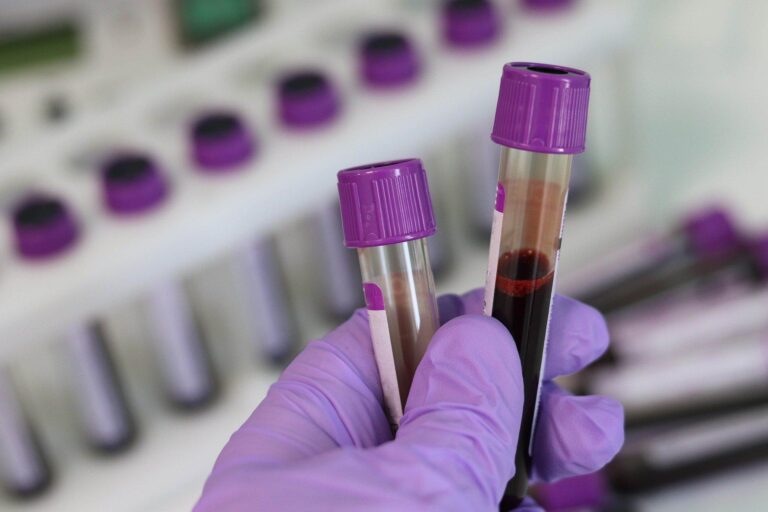 imagem de Conheça um dos tipos de testagem para o novo coronavírus: Sorologia