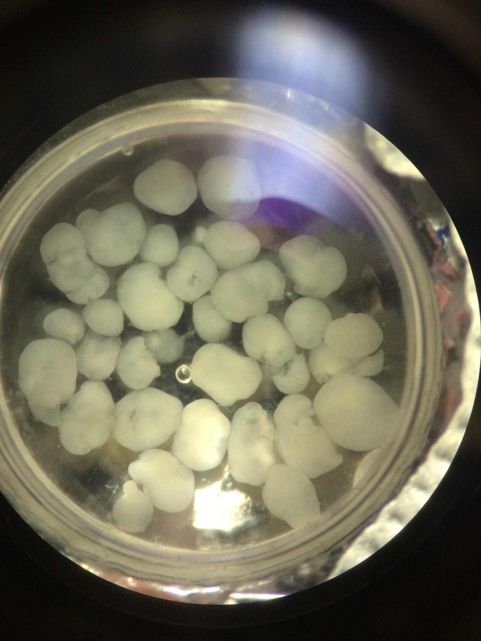 imagem de Estudos com mini órgãos nos ajudam a entender como o novo coronavírus afeta o corpo