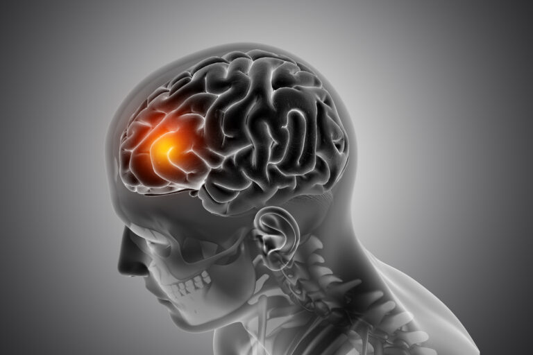 imagem de Palestra: Neuroprogressão e a Demência Funcional no Transtorno Bipolar