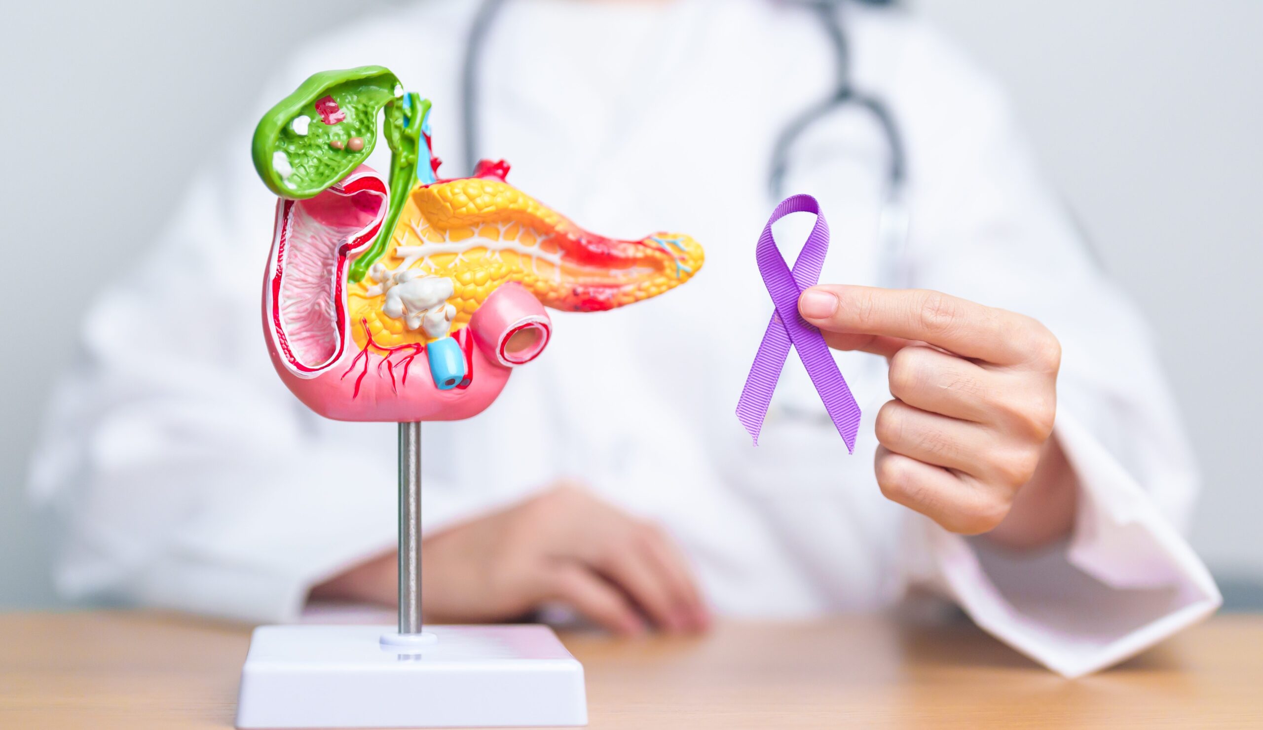 Setembro Roxo: Considerada fator de risco para o câncer de pâncreas, Pancreatite Crônica afeta principalmente idosos, fumantes e populações do Sul e Sudeste