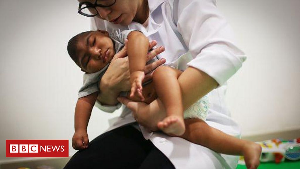 imagem de BBC News Brasil: Zika: como desnutrição, toxinas na água e agrotóxicos criaram 'bolsões de microcefalia' no Brasil