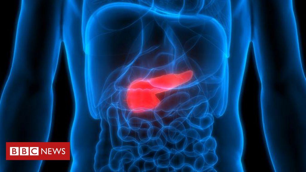 imagem de Por que câncer de pâncreas entrou para a lista dos que mais matam no Brasil
 - BBC News Brasil